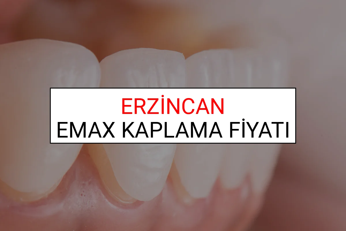 Erzincan Emax Diş Kaplama Fiyatları Ne Kadar? (2025 Erzincan TDB Emax Diş Fiyatları)