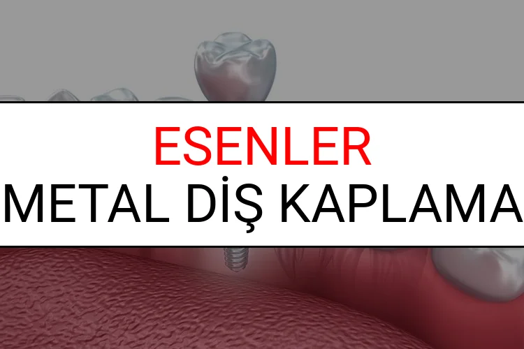 Esenler Metal Diş Kaplama Fiyatları Ne Kadar? (2025 Esenler TDB Metal Destekli Diş Fiyatları)