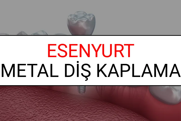Esenyurt Metal Diş Kaplama Fiyatları Ne Kadar? (2025 Esenyurt TDB Metal Destekli Diş Fiyatları)
