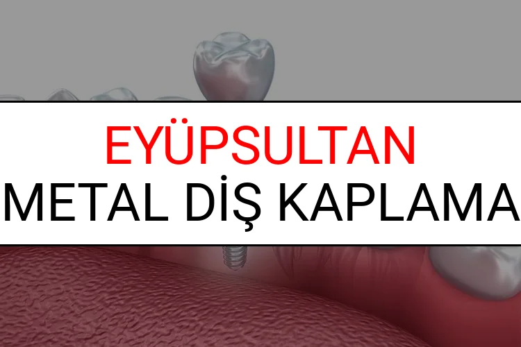 Eyüpsultan Metal Diş Kaplama Fiyatları Ne Kadar? (2025 Eyüpsultan TDB Metal Destekli Diş Fiyatları)