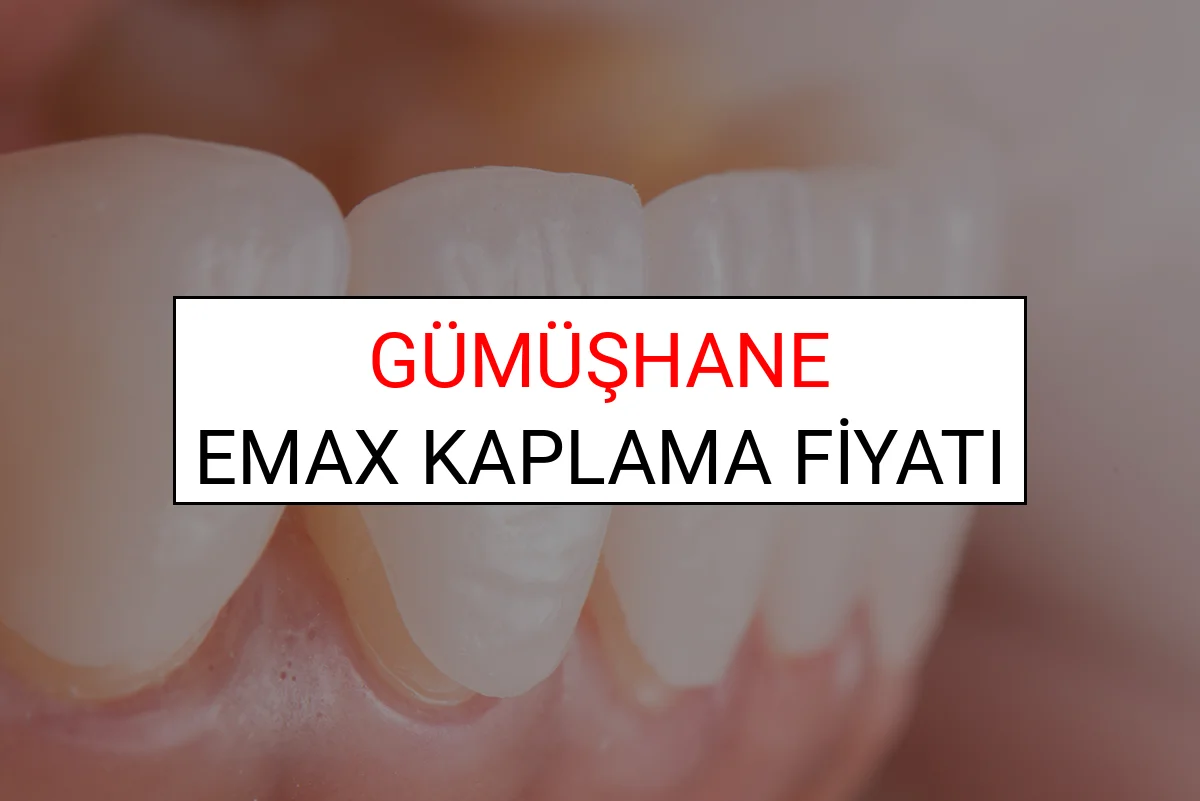 Gümüşhane Emax Diş Kaplama Fiyatları Ne Kadar? (2025 Gümüşhane TDB Emax Diş Fiyatları)