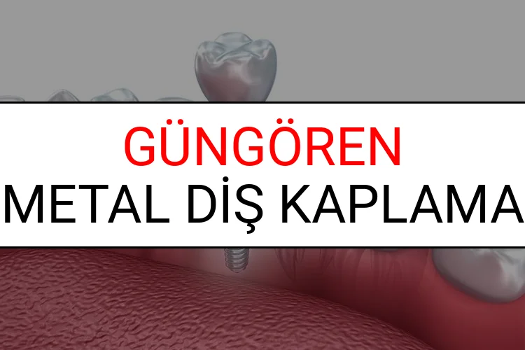 Güngören Metal Diş Kaplama Fiyatları Ne Kadar? (2025 Güngören TDB Metal Destekli Diş Fiyatları)