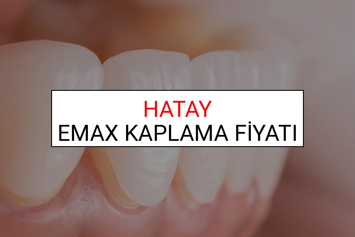 Hatay Emax Diş Kaplama Fiyatları Ne Kadar? (2025 Hatay TDB Emax Diş Fiyatları)