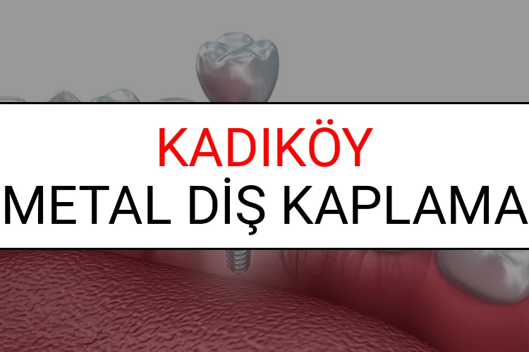 Kadıköy Metal Diş Kaplama Fiyatları Ne Kadar? (2025 Kadıköy TDB Metal Destekli Diş Fiyatları)