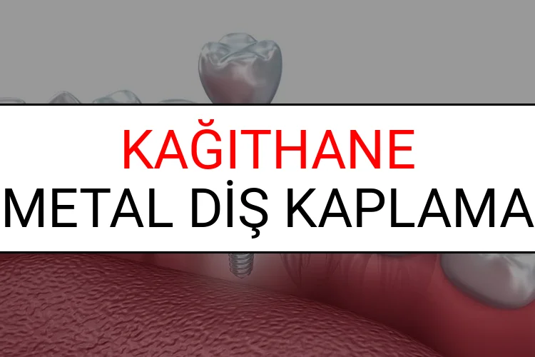 Kağıthane Metal Diş Kaplama Fiyatları Ne Kadar? (2025 Kağıthane TDB Metal Destekli Diş Fiyatları)