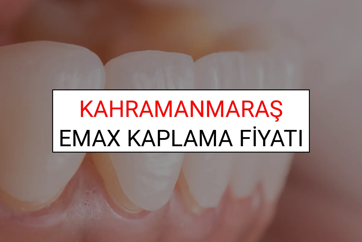 Kahramanmaraş Emax Diş Kaplama Fiyatları Ne Kadar? (2025 Kahramanmaraş TDB Emax Diş Fiyatları)