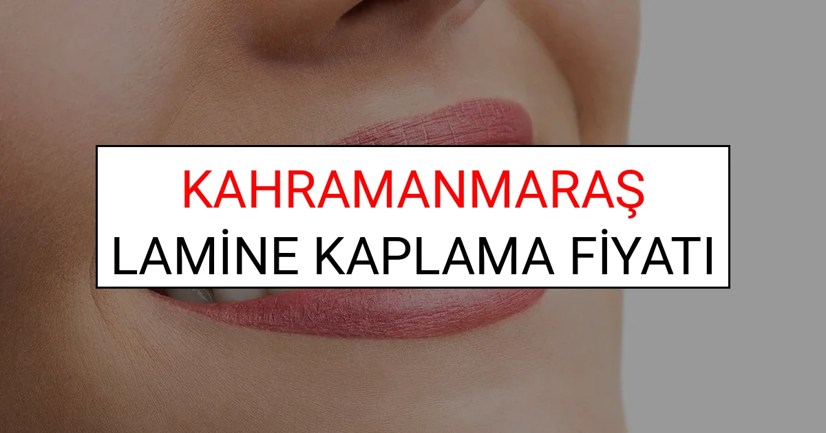 Kahramanmaraş Lamine Diş Kaplama Fiyatları Ne Kadar? (2025 Kahramanmaraş TDB Lamine Yaprak Diş Fiyatları)