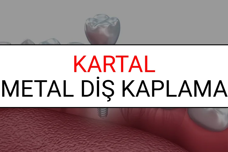 Kartal Metal Diş Kaplama Fiyatları Ne Kadar? (2025 Kartal TDB Metal Destekli Diş Fiyatları)