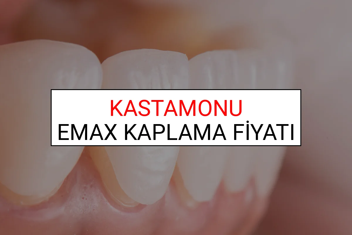 Kastamonu Emax Diş Kaplama Fiyatları Ne Kadar? (2025 Kastamonu TDB Emax Diş Fiyatları)