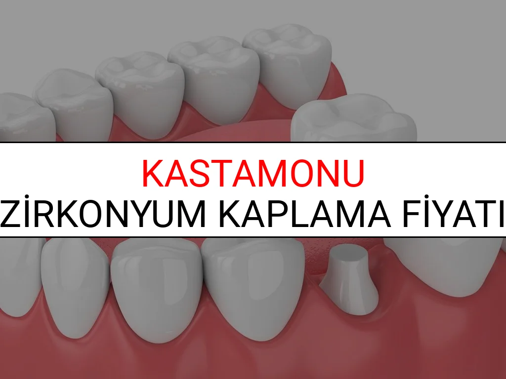 Kastamonu Zirkonyum Diş Kaplama Fiyatları Ne Kadar? (2025 Kastamonu TDB Zirkonyum Diş Fiyatları)