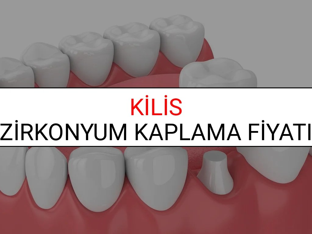 Kilis Zirkonyum Diş Kaplama Fiyatları Ne Kadar? (2025 Kilis TDB Zirkonyum Diş Fiyatları)