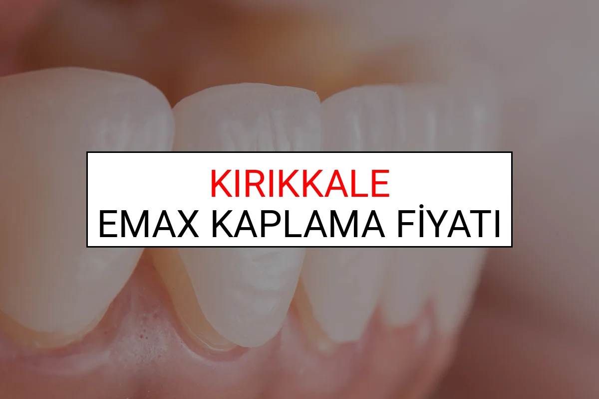 Kırıkkale Emax Diş Kaplama Fiyatları Ne Kadar? (2025 Kırıkkale TDB Emax Diş Fiyatları)
