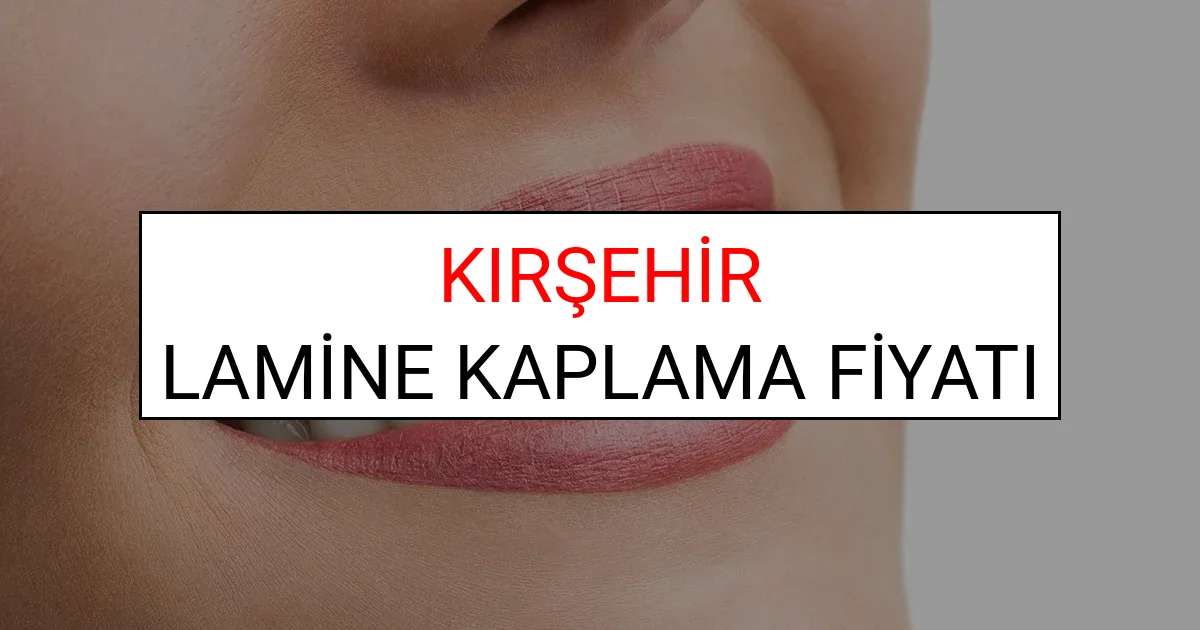 Kırşehir Lamine Diş Kaplama Fiyatları Ne Kadar? (2025 Kırşehir TDB Lamine Yaprak Diş Fiyatları)