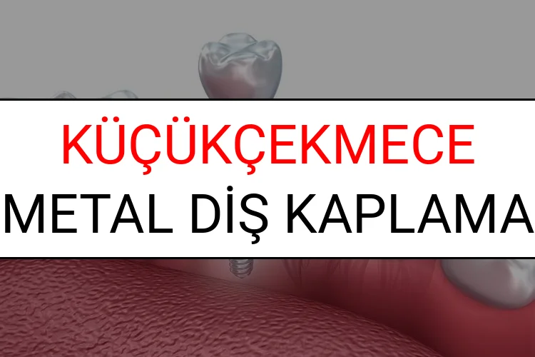 Küçükçekmece Metal Diş Kaplama Fiyatları Ne Kadar? (2025 Küçükçekmece TDB Metal Destekli Diş Fiyatları)