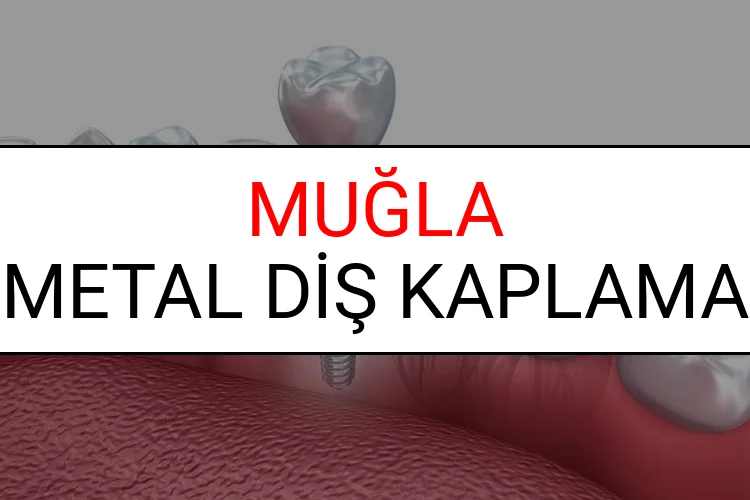 Muğla Metal Diş Kaplama Fiyatları Ne Kadar? (2025 Muğla TDB Metal Destekli Diş Fiyatları)
