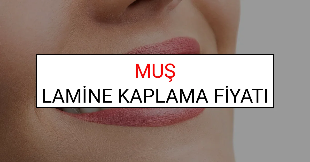 Muş Lamine Diş Kaplama Fiyatları Ne Kadar? (2025 Muş TDB Lamine Yaprak Diş Fiyatları)