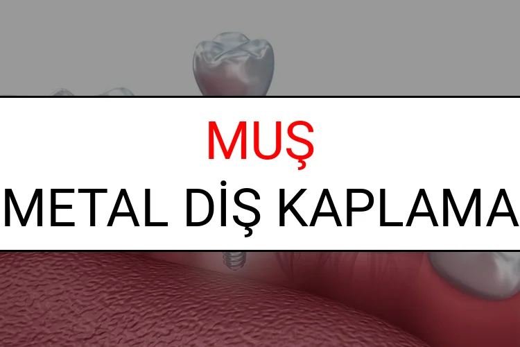 Muş Metal Diş Kaplama Fiyatları Ne Kadar? (2025 Muş TDB Metal Destekli Diş Fiyatları)