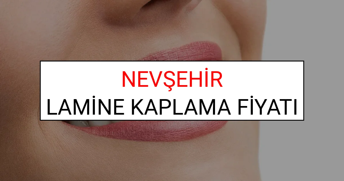 Nevşehir Lamine Diş Kaplama Fiyatları Ne Kadar? (2025 Nevşehir TDB Lamine Yaprak Diş Fiyatları)