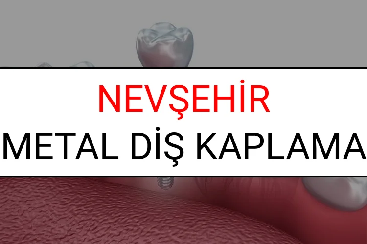 Nevşehir Metal Diş Kaplama Fiyatları Ne Kadar? (2025 Nevşehir TDB Metal Destekli Diş Fiyatları)
