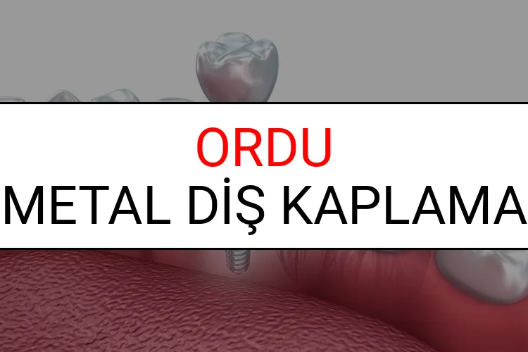 Ordu Metal Diş Kaplama Fiyatları Ne Kadar? (2025 Ordu TDB Metal Destekli Diş Fiyatları)