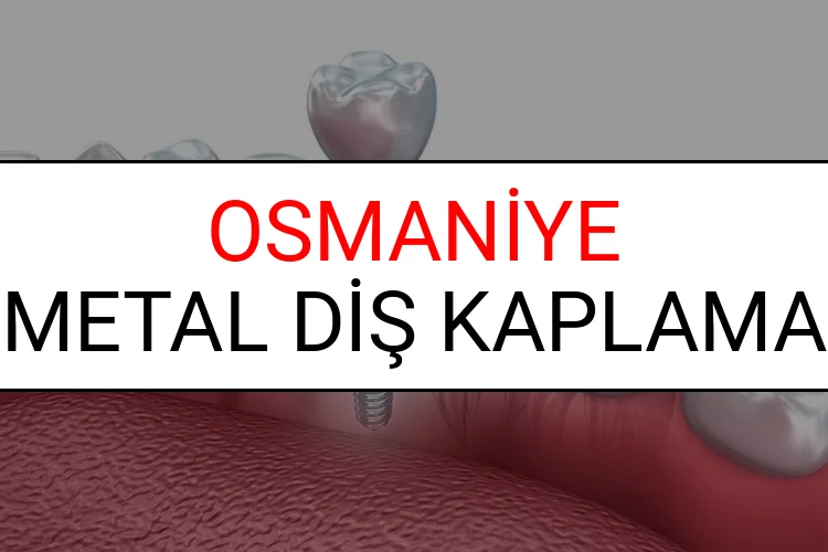 Osmaniye Metal Diş Kaplama Fiyatları Ne Kadar? (2025 Osmaniye TDB Metal Destekli Diş Fiyatları)