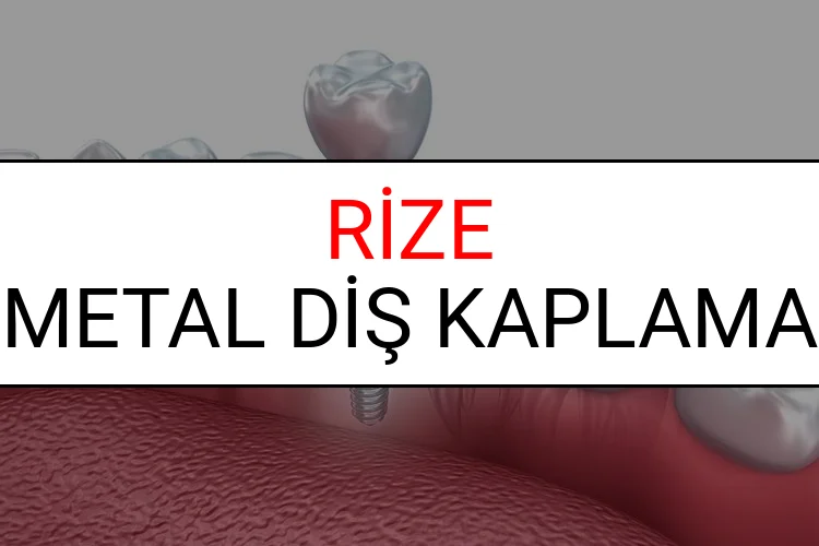 Rize Metal Diş Kaplama Fiyatları Ne Kadar? (2025 Rize TDB Metal Destekli Diş Fiyatları)