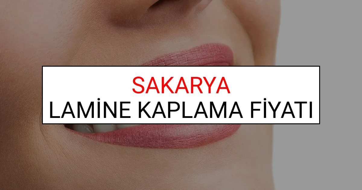Sakarya Lamine Diş Kaplama Fiyatları Ne Kadar? (2025 Sakarya TDB Lamine Yaprak Diş Fiyatları)