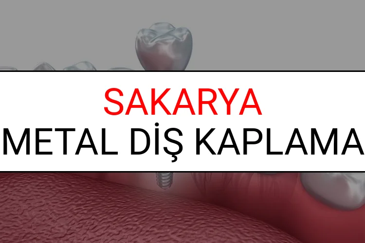 Sakarya Metal Diş Kaplama Fiyatları Ne Kadar? (2025 Sakarya TDB Metal Destekli Diş Fiyatları)