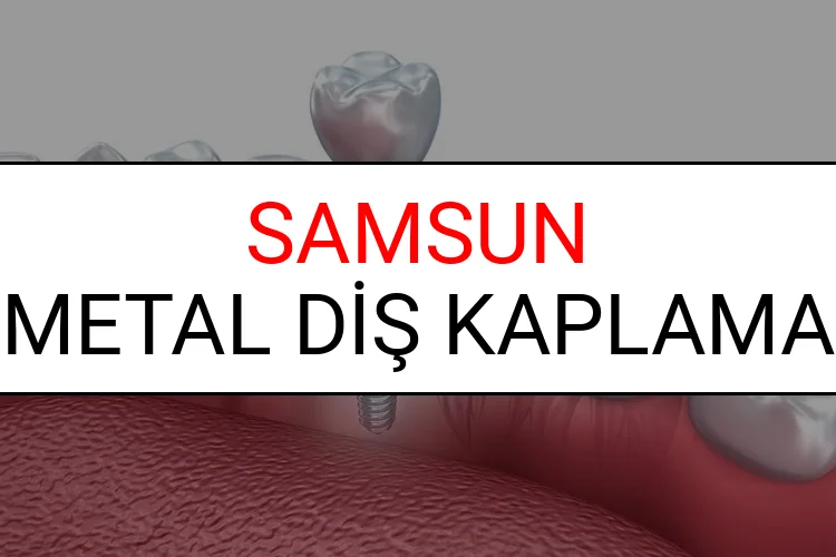 Samsun Metal Diş Kaplama Fiyatları Ne Kadar? (2025 Samsun TDB Metal Destekli Diş Fiyatları)