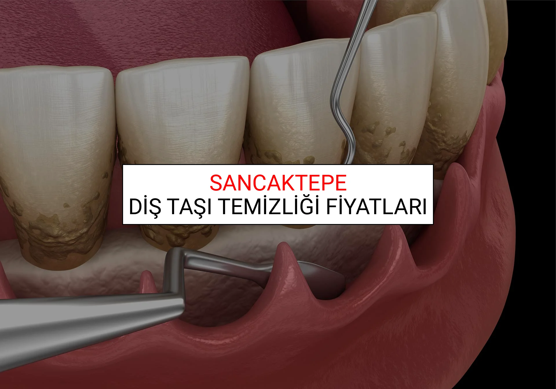 Sancaktepe Diş Taşı Temizliği Fiyatları Ne Kadar? (2025 Sancaktepe TDB Diş Taşı Temizliği Fiyat)