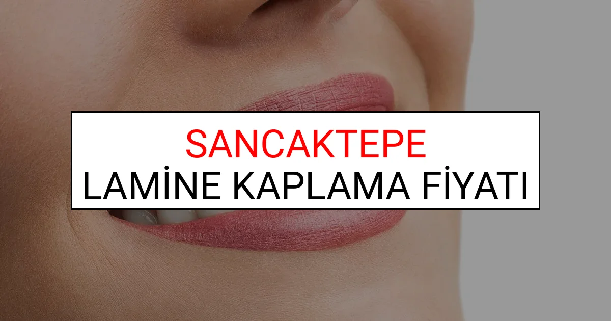 Sancaktepe Lamine Diş Kaplama Fiyatları Ne Kadar? (2025 Sancaktepe TDB Lamine Yaprak Diş Fiyatları)