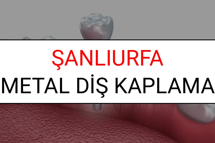 Şanlıurfa Metal Diş Kaplama Fiyatları Ne Kadar? (2025 Şanlıurfa TDB Metal Destekli Diş Fiyatları)