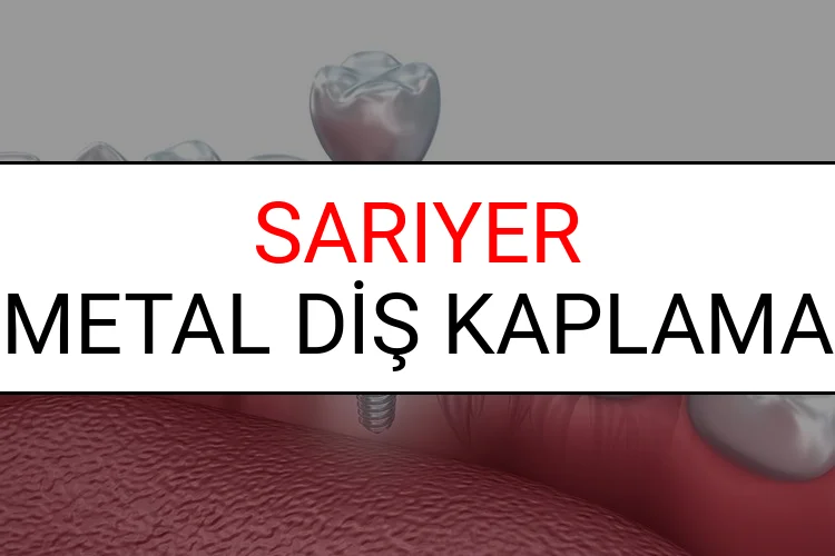 Sarıyer Metal Diş Kaplama Fiyatları Ne Kadar? (2025 Sarıyer TDB Metal Destekli Diş Fiyatları)