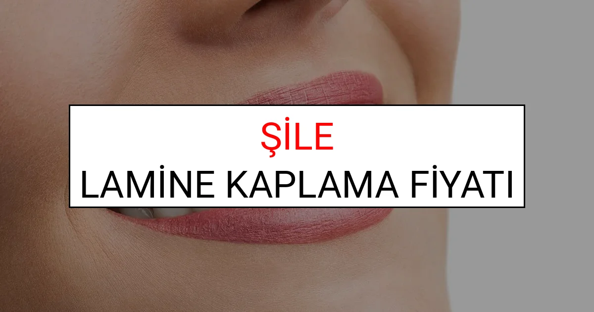 Şile Lamine Diş Kaplama Fiyatları Ne Kadar? (2025 Şile TDB Lamine Yaprak Diş Fiyatları)