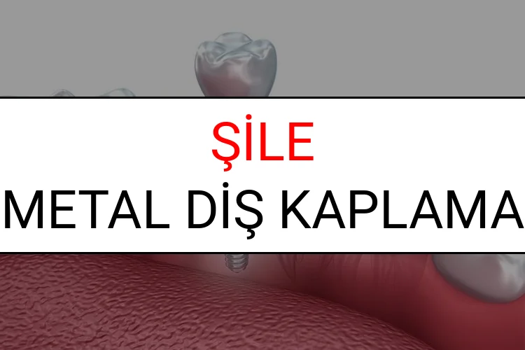 Şile Metal Diş Kaplama Fiyatları Ne Kadar? (2025 Şile TDB Metal Destekli Diş Fiyatları)