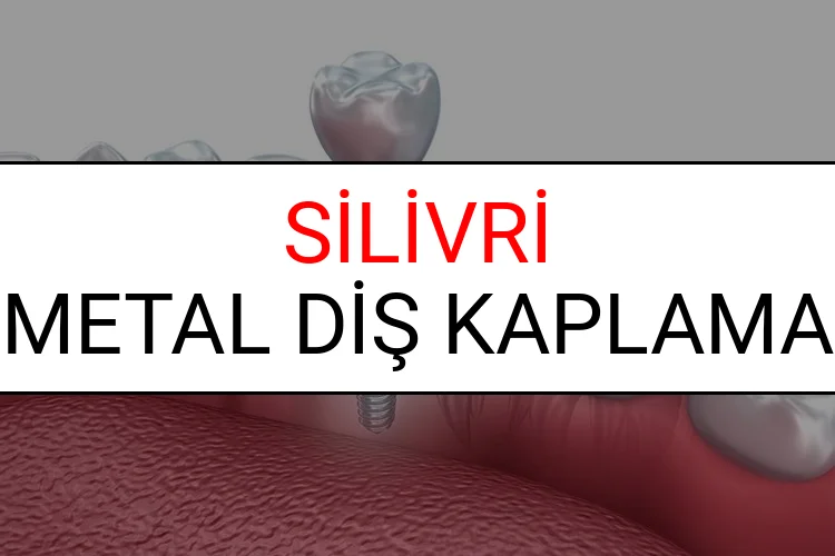 Silivri Metal Diş Kaplama Fiyatları Ne Kadar? (2025 Silivri TDB Metal Destekli Diş Fiyatları)