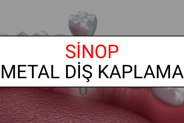 Sinop Metal Diş Kaplama Fiyatları Ne Kadar? (2025 Sinop TDB Metal Destekli Diş Fiyatları)