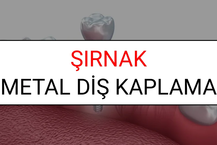 Şırnak Metal Diş Kaplama Fiyatları Ne Kadar? (2025 Şırnak TDB Metal Destekli Diş Fiyatları)