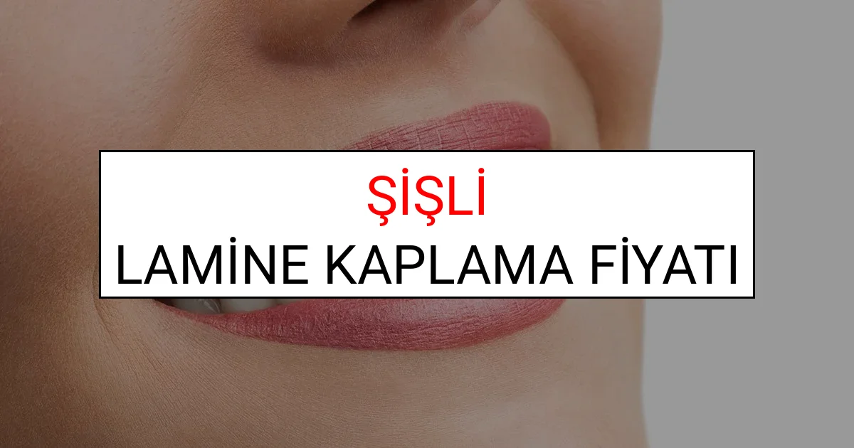 Şişli Lamine Diş Kaplama Fiyatları Ne Kadar? (2025 Şişli TDB Lamine Yaprak Diş Fiyatları)