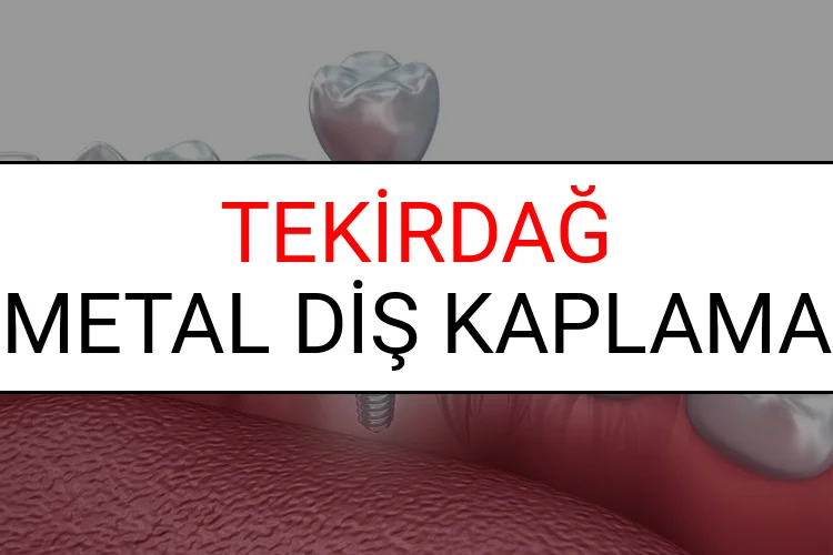 Tekirdağ Metal Diş Kaplama Fiyatları Ne Kadar? (2025 Tekirdağ TDB Metal Destekli Diş Fiyatları)