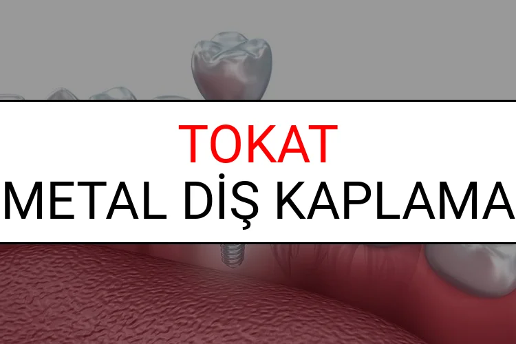 Tokat Metal Diş Kaplama Fiyatları Ne Kadar? (2025 Tokat TDB Metal Destekli Diş Fiyatları)