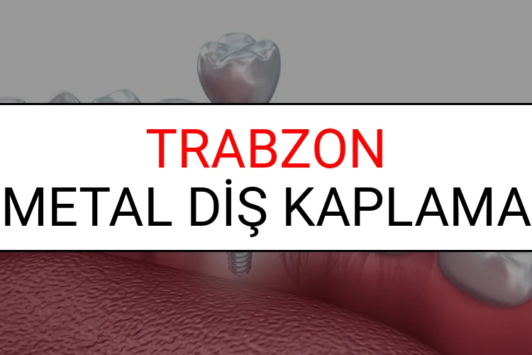 Trabzon Metal Diş Kaplama Fiyatları Ne Kadar? (2025 Trabzon TDB Metal Destekli Diş Fiyatları)