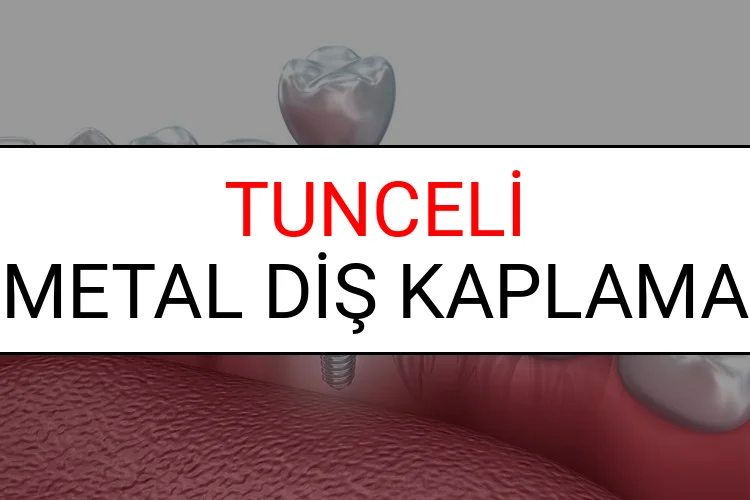 Tunceli Metal Diş Kaplama Fiyatları Ne Kadar? (2025 Tunceli TDB Metal Destekli Diş Fiyatları)