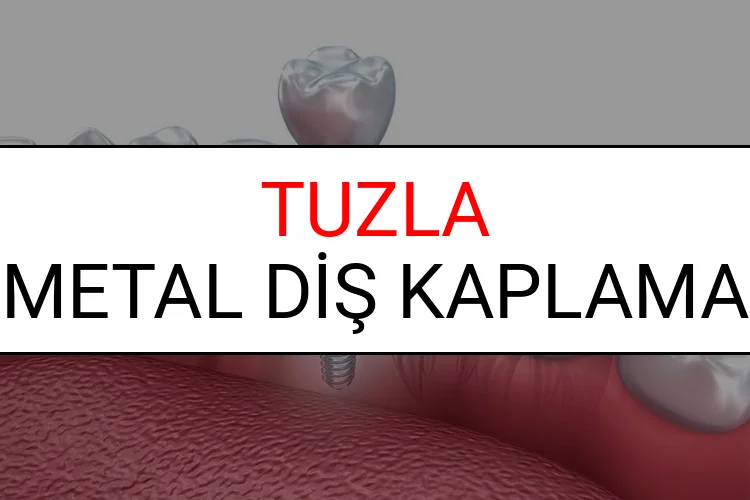 Tuzla Metal Diş Kaplama Fiyatları Ne Kadar? (2025 Tuzla TDB Metal Destekli Diş Fiyatları)