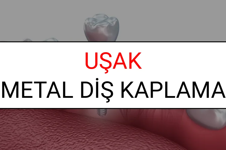 Uşak Metal Diş Kaplama Fiyatları Ne Kadar? (2025 Uşak TDB Metal Destekli Diş Fiyatları)