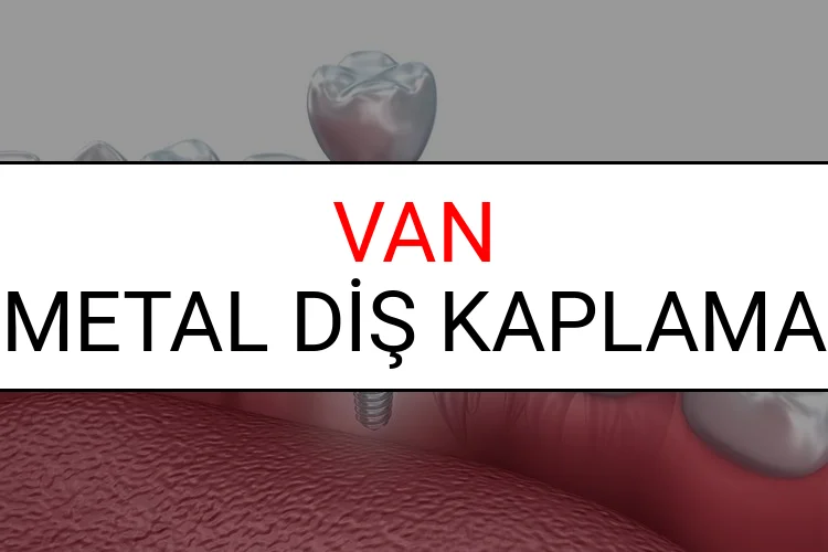 Van Metal Diş Kaplama Fiyatları Ne Kadar? (2025 Van TDB Metal Destekli Diş Fiyatları)