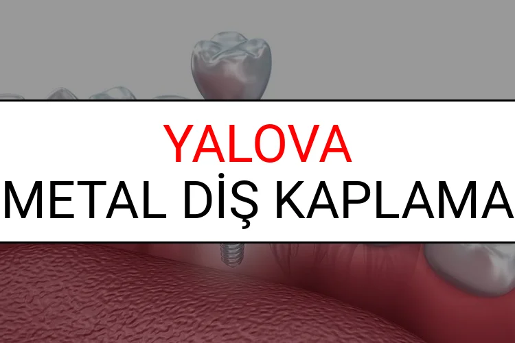 Yalova Metal Diş Kaplama Fiyatları Ne Kadar? (2025 Yalova TDB Metal Destekli Diş Fiyatları)