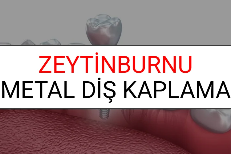 Zeytinburnu Metal Diş Kaplama Fiyatları Ne Kadar? (2025 Zeytinburnu TDB Metal Destekli Diş Fiyatları)
