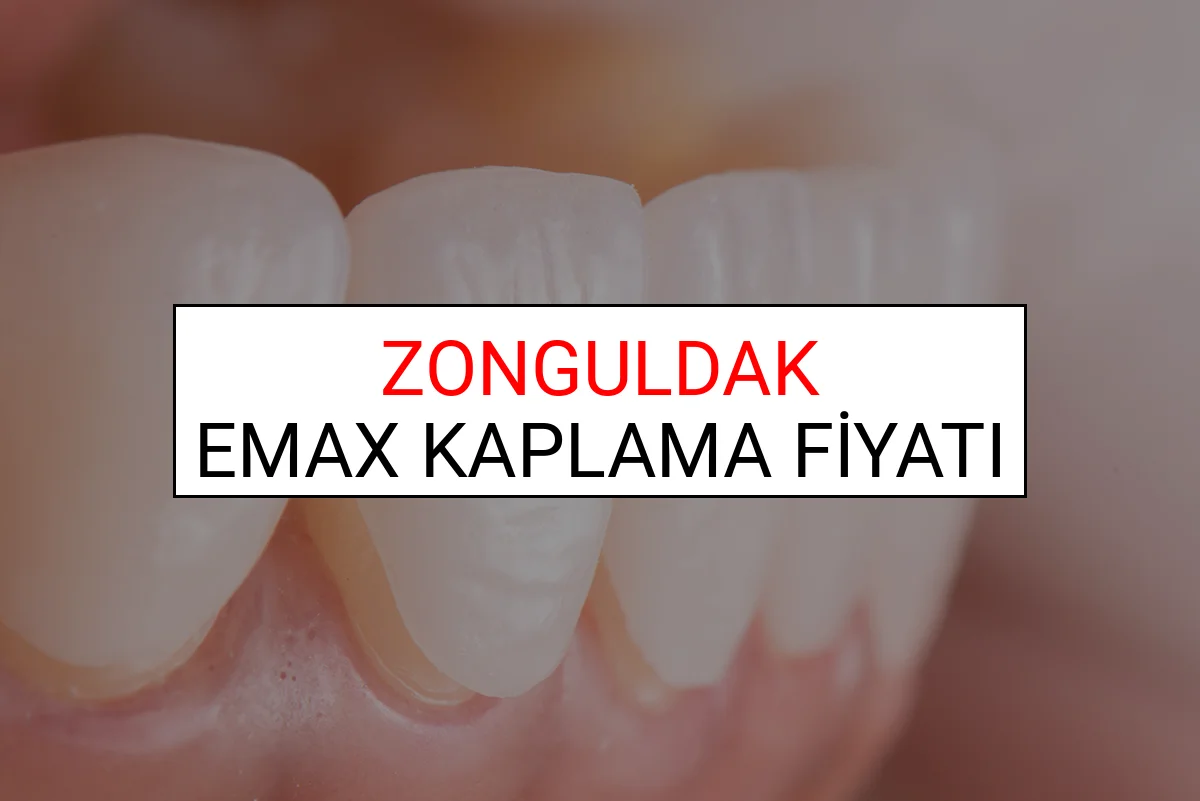 Zonguldak Emax Diş Kaplama Fiyatları Ne Kadar? (2025 Zonguldak TDB Emax Diş Fiyatları)