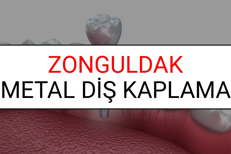 Zonguldak Metal Diş Kaplama Fiyatları Ne Kadar? (2025 Zonguldak TDB Metal Destekli Diş Fiyatları)